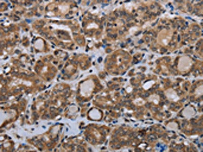 Anti-MTSS1 Antibody