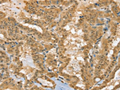 Anti-PSMC1 Antibody