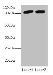 Anti-POSTN Antibody