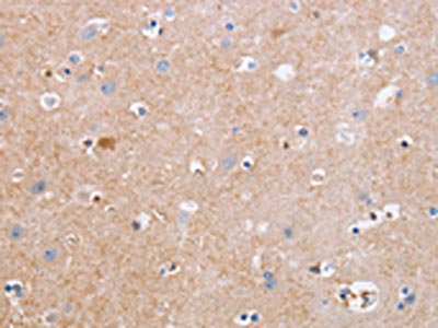 Anti-CDC7 Antibody