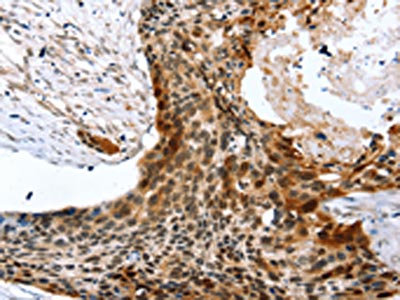 Anti-SYNPO2 / Synaptopodin 2 Antibody
