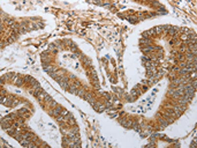 Anti-NEUROG1 Antibody