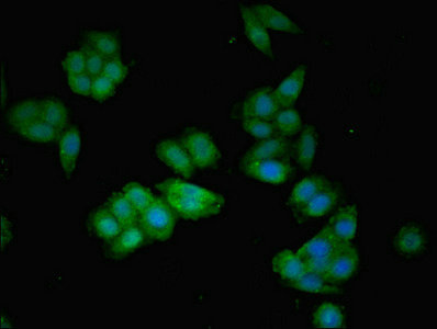 Anti-AGT Antibody