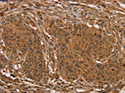 Anti-PRC1 Antibody