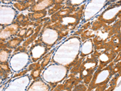 Anti-SRGAP3 Antibody