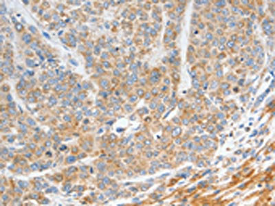 Anti-NTS Antibody
