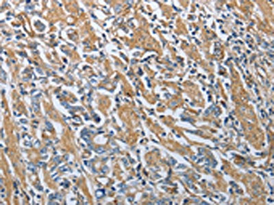 Anti-RETN Antibody
