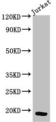 Anti-CD247 Antibody