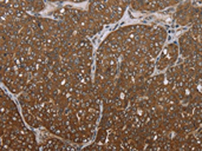 Anti-FOLH1B / Putative N-acetylated-alpha-linked acidic dipeptidase Antibody