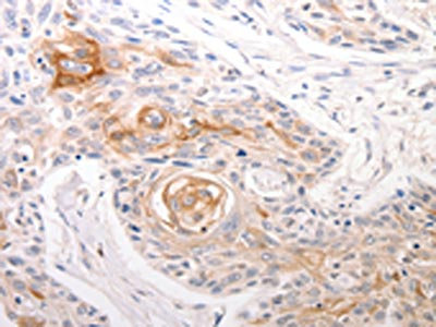 Anti-DFFB / DNA fragmentation factor subunit beta Antibody