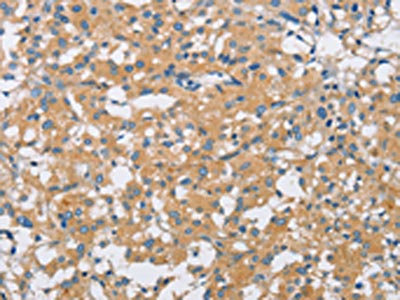 Anti-SH3GLB1 Antibody