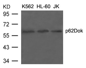 Anti-DOK1 (Ab-398) / p62Dok Antibody