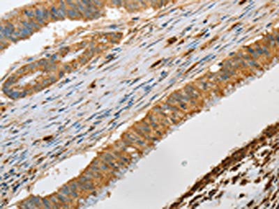Anti-GZMB / Granzyme B Antibody
