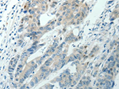 Anti-RNF126 Antibody