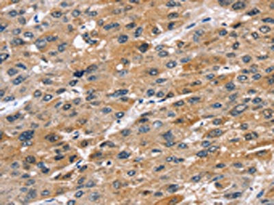 Anti-STK33 / Serine threonine-protein kinase 33 Antibody