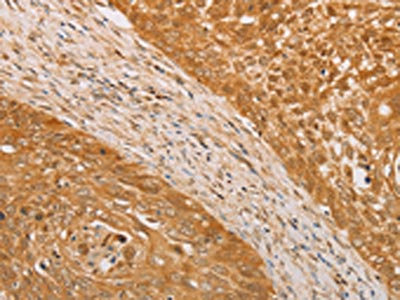 Anti-STK40 / Serine/threonine-protein kinase 40 Antibody