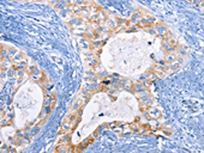 Anti-CFLAR Antibody