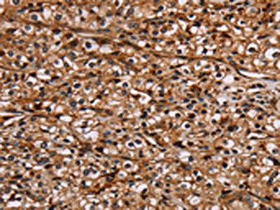Anti-NOC2L Antibody