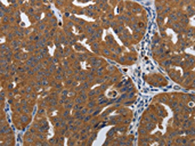 Anti-PDCD2 Antibody