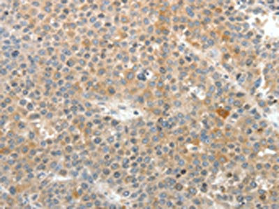 Anti-SV2A / Synaptic vesicle glycoprotein 2A Antibody