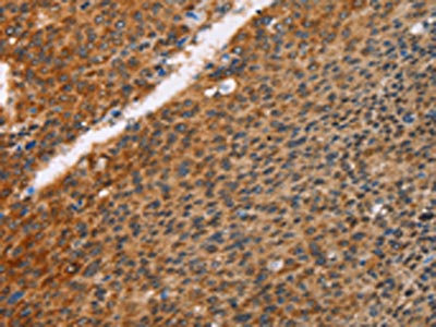 Anti-PRKAA2 Antibody