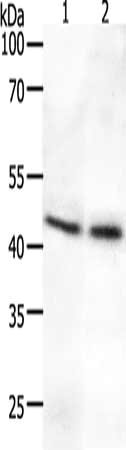 Anti-SYT2 / Synaptotagmin 2 Antibody