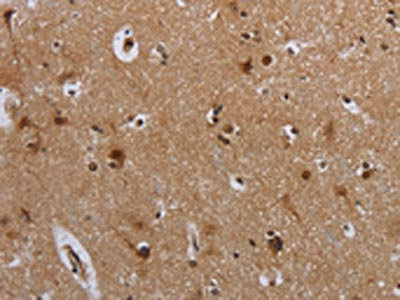 Anti-MTBP Antibody