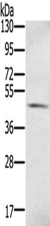 Anti-S100PBP Antibody