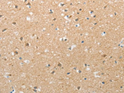 Anti-TACR2 / Substance-K receptor Antibody
