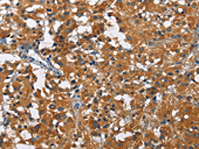 Anti-KLF7 / Krueppel like factor 7 Antibody