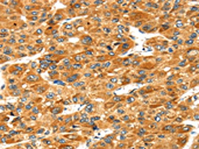 Anti-STXBP4 / Syntaxin binding protein 4 Antibody