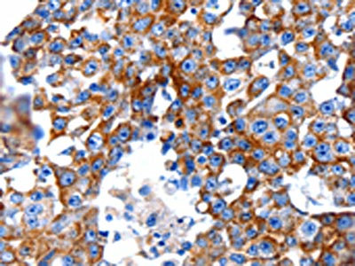 Anti-CLEC7A Antibody