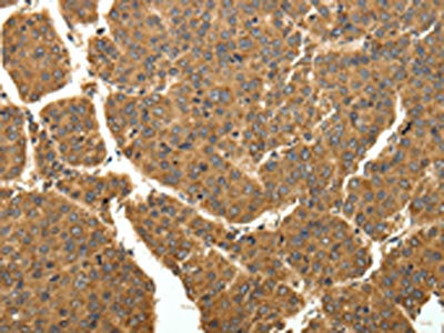Anti-COQ3 Antibody