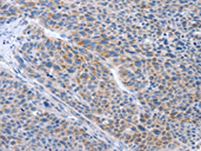 Anti-BTG2 Antibody