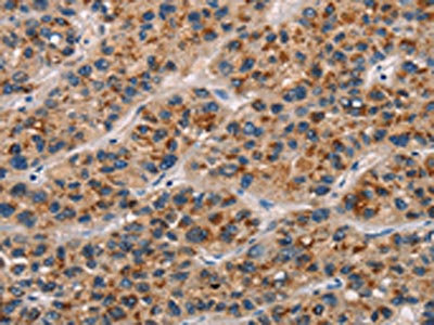 Anti-CD80 Antibody