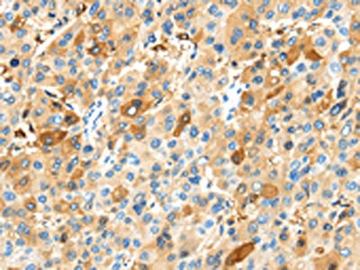 Anti-MAP3K10 Antibody