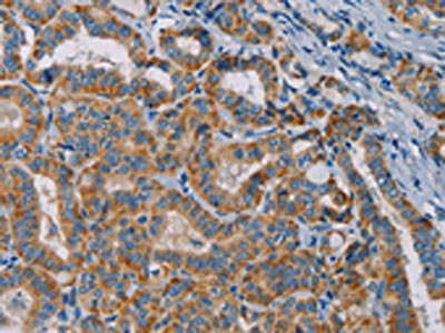Anti-TAB3 / TGF-beta-activated kinase 1 and MAP3K7 binding protein 3 Antibody