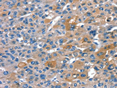 Anti-RNF7 Antibody