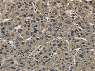 Anti-IMPAD1 / BNT2 Antibody