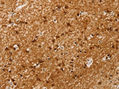Anti-SSX4 Antibody