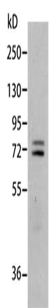 Anti-MMP2 Antibody