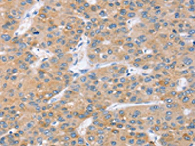 Anti-SLC27A2 Antibody