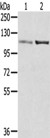 Anti-SENP7 / Sentrin specific protease 7 Antibody