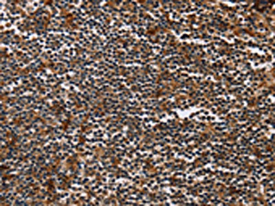 Anti-MAGEA3 Antibody