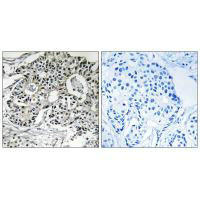 Anti-PXMP2 Antibody