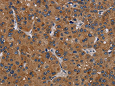 Anti-PDGFC Antibody