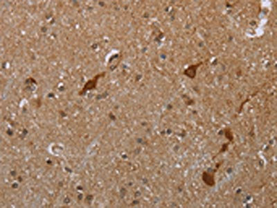Anti-CASP8AP2 Antibody