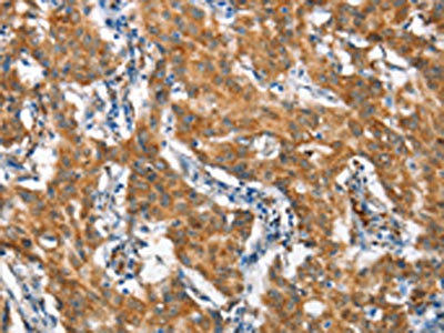 Anti-STAT2 Antibody