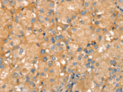 Anti-SLC41A2 Antibody