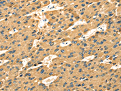 Anti-SAMD7 Antibody